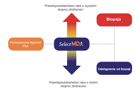 Płynna biopsja prostaty - Test SelectMDx Liquid Biopsy