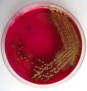 Posiew moczu - wzrost E. coli na podłożu agarowym