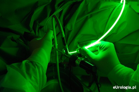 Operacja laserem zielonym